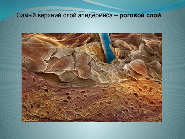 Самый верхний слой эпидермиса –  роговой слой .