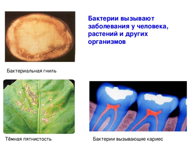 Бактерии вызывают заболевания у человека, растений и других организмов