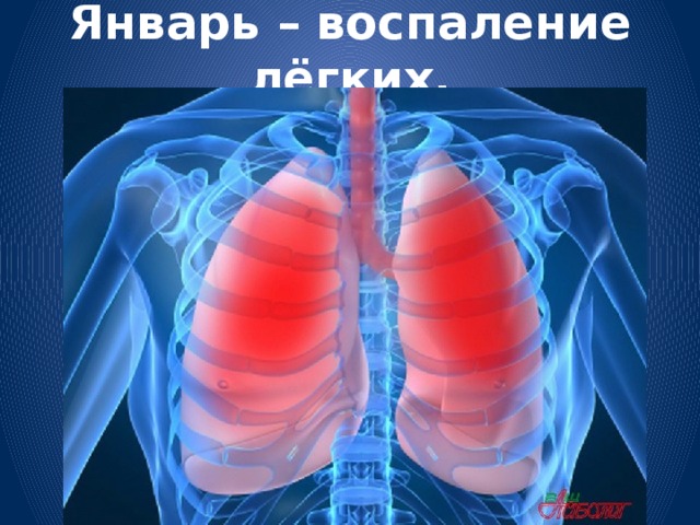 Январь – воспаление лёгких.