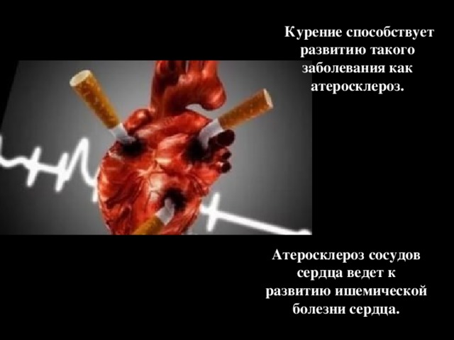 Курение способствует развитию такого заболевания как атеросклероз. Атеросклероз сосудов сердца ведет к развитию ишемической болезни сердца.