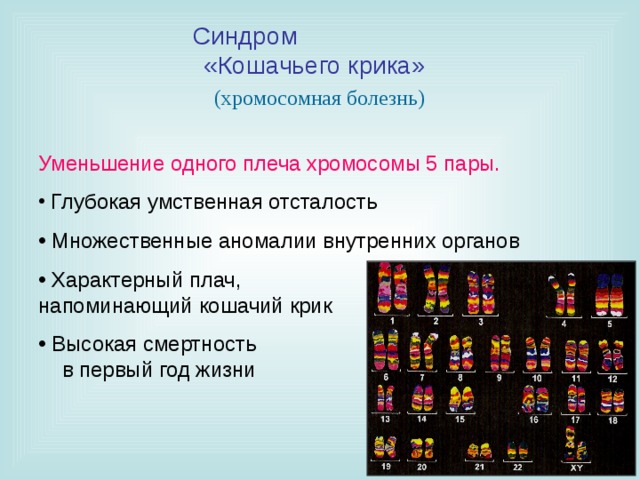 Синдром «Кошачьего крика» (хромосомная болезнь) Уменьшение одного плеча хромосомы 5 пары.