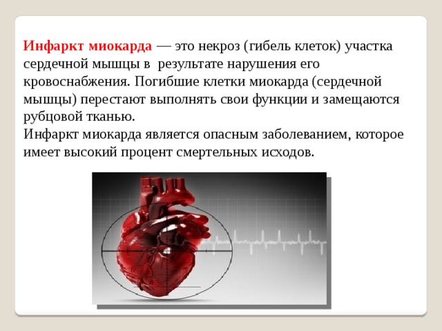 Инфаркт миокарда — это некроз (гибель клеток) участка сердечной мышцы в  результате нарушения его  кровоснабжения. Погибшие клетки миокарда (сердечной мышцы) перестают выполнять свои функции и замещаются рубцовой тканью.  Инфаркт миокарда является опасным заболеванием, которое имеет высокий процент смертельных исходов.